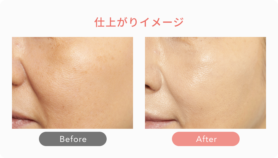 仕上がりイメージ Before After